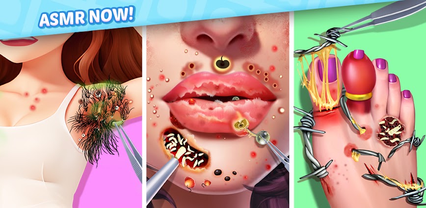 Screw Match: ASMR Blast